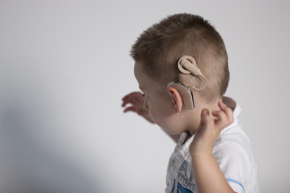  인공와우(코클리어 임플란트, Cochlear Implant)에 대해 알아보자