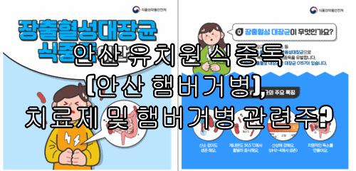  안산 유치원 식중독(안산 햄버거병), 치료제 및 햄버거병 관련주?