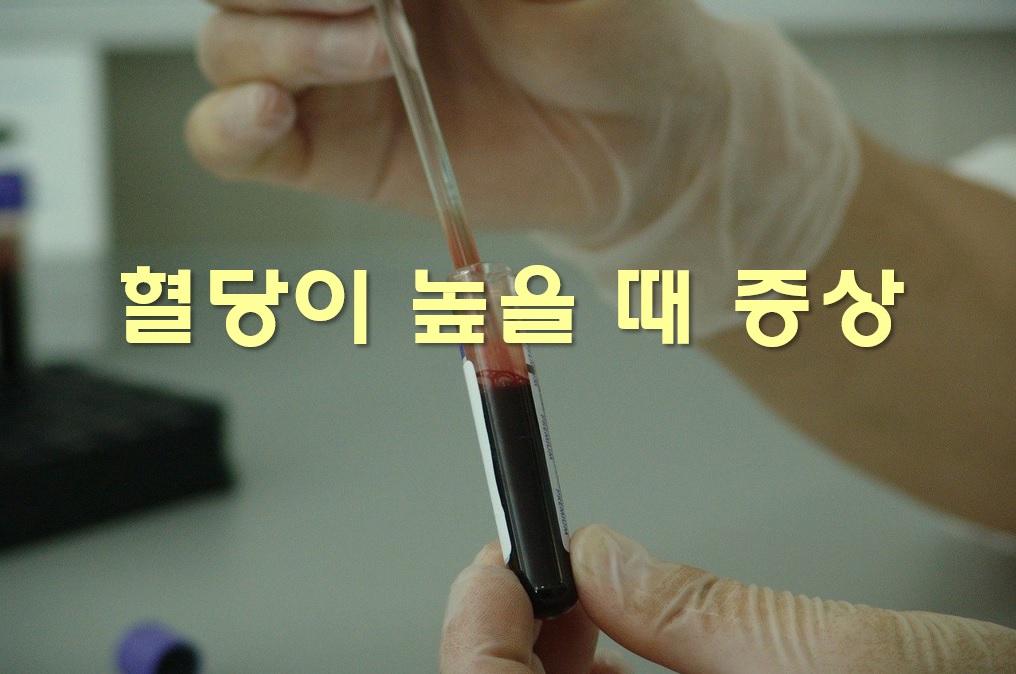 혈당이 높을 때 증상과 혈당 낮추는 방법
