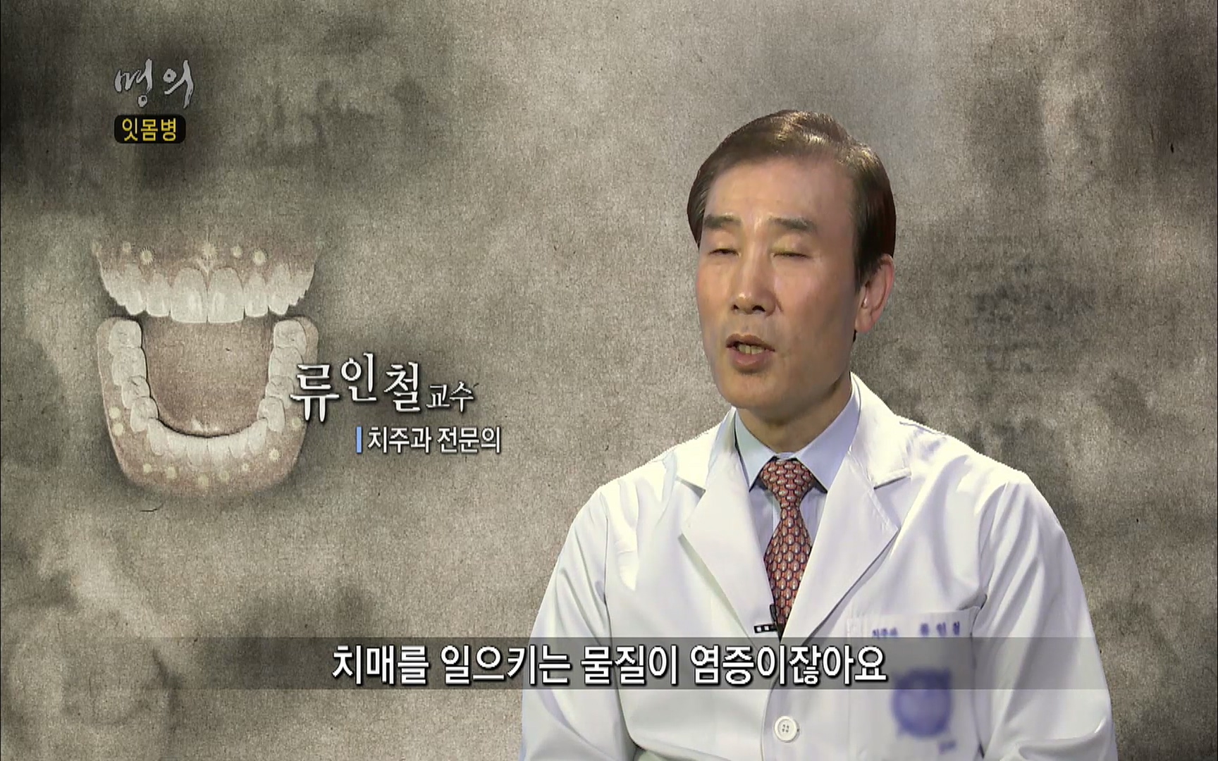 EBS 명의 헬스케어 - TV - 교육의 중심 EBS2015년 1월 16일 (금) 밤 9시 50분, EBS1.mp4_20220505_145604.481.jpg