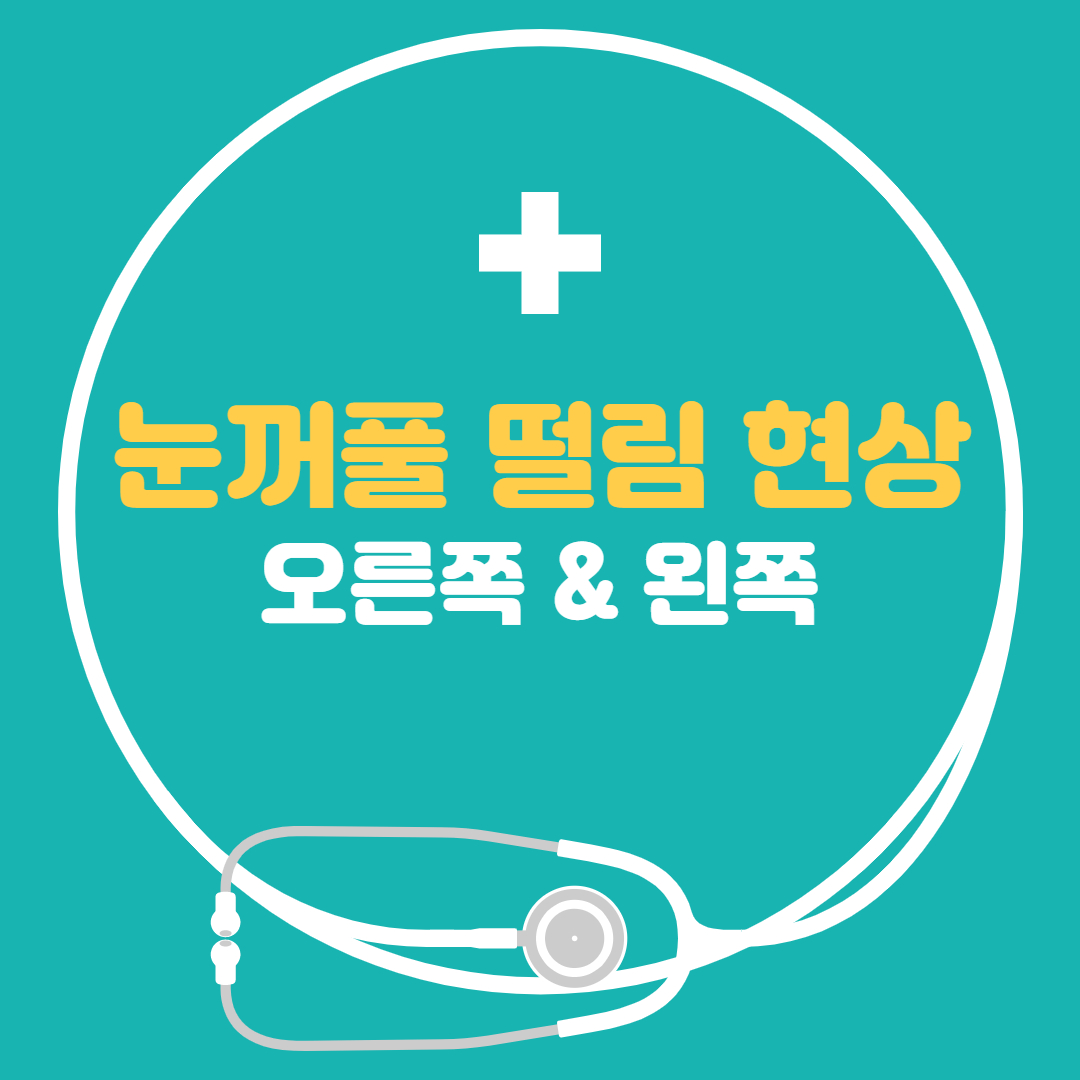 왼쪽 오른쪽 눈꺼풀 떨림현상 - 눈꺼풀이 떨리는 증상 간단하게 알아봐요