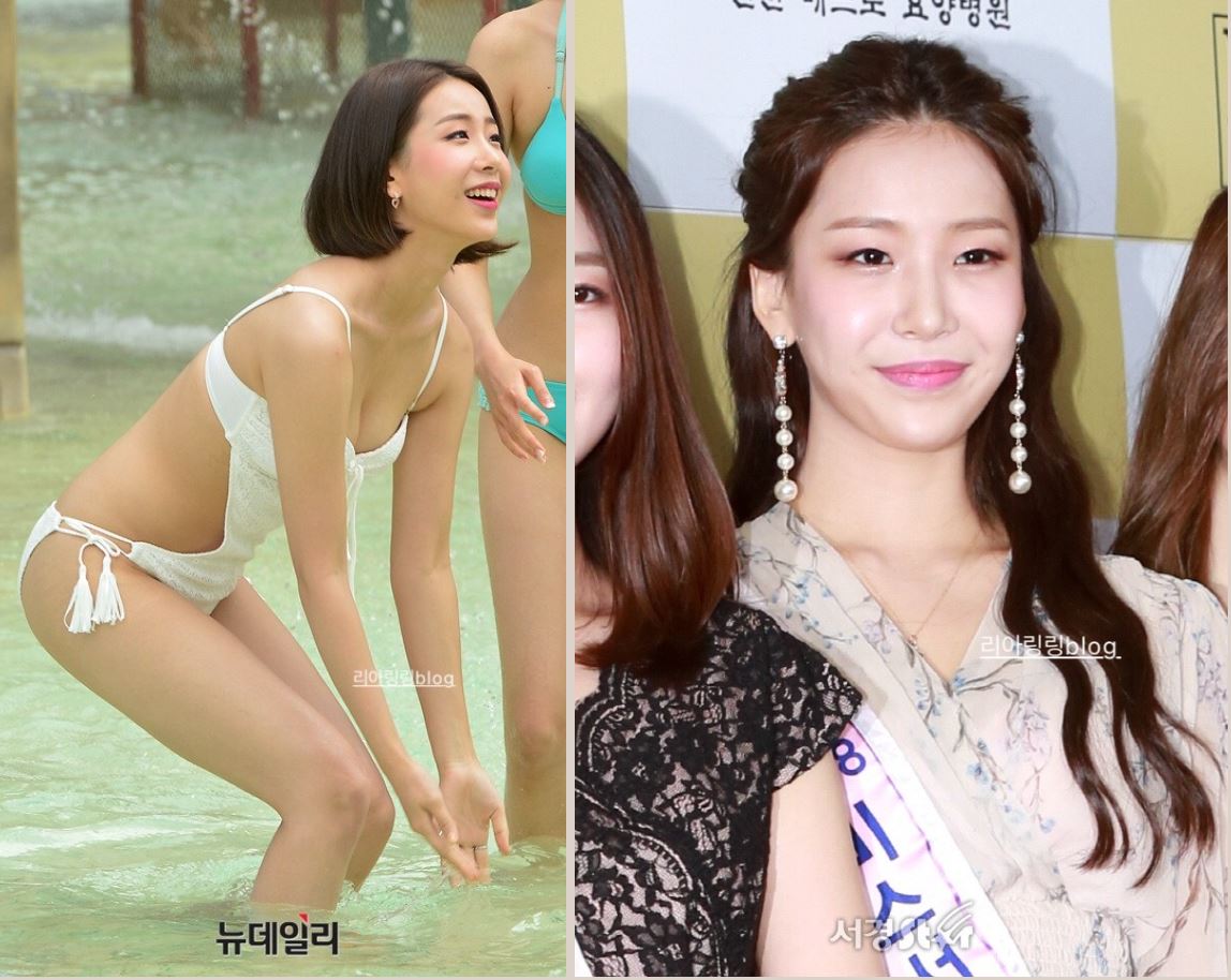  미스코리아 서예진 음주운전"xx 아프죠"