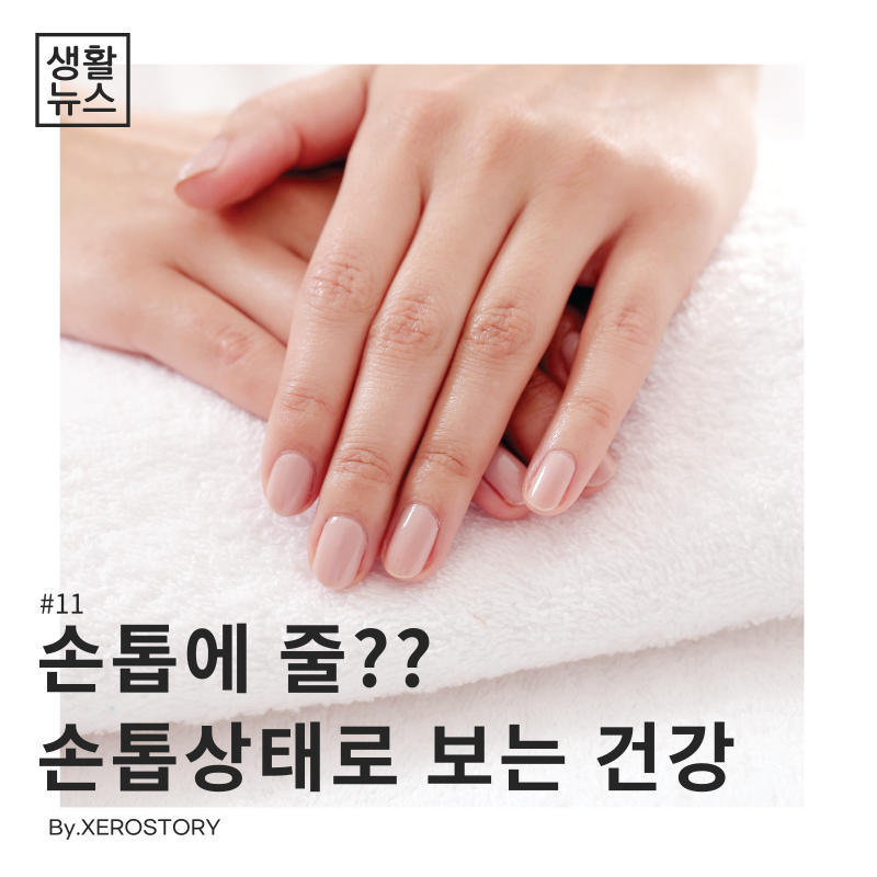  생활건강#11 손톱으로 건강상태를 알 수 있다?? 손톱으로 보는 건강상태