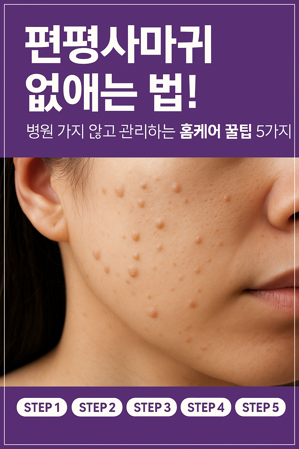 병원 가지 않고 관리하는 홈케어 꿀팁 5가지