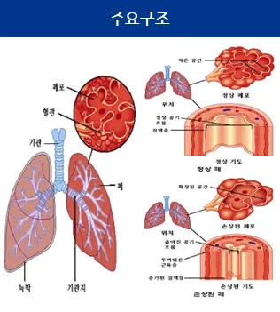 폐 섬유화 단계별 증상 원인 치료방법_4