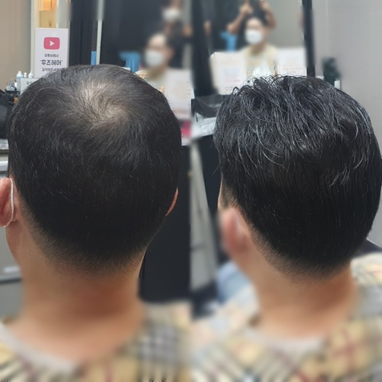 부분가발 여기 있었네 6