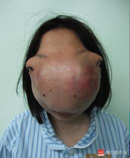 9살때부터 얼굴이 말처럼 변해버린 소녀에게 기적같은 일이 일어납니다