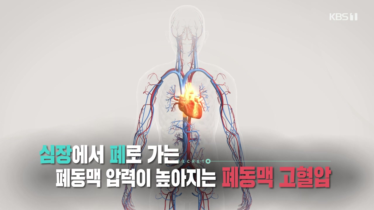 생로병사의 비밀.E900.240215p-NEXT.mp4_20240215_200933.702.jpg