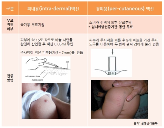  아기 BCG접종 경피용VS피내용, 접종 시기와 차이점