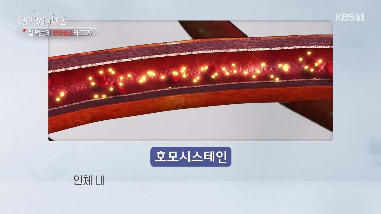 생로병사의 비밀.E906.240328p-NEXT.mp4_20240328_210407.122.jpg