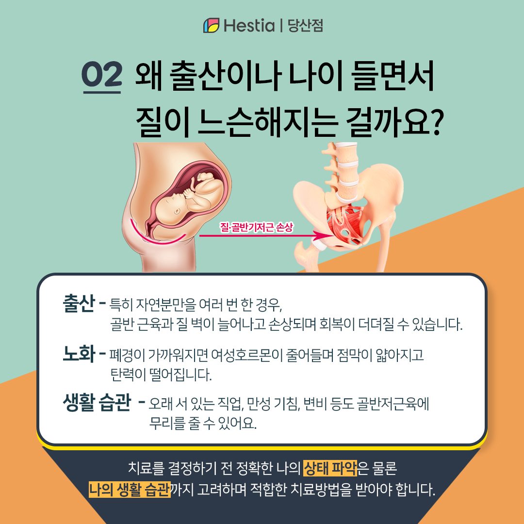 왜 출산이나 나이들면 질이 늘어나나요?