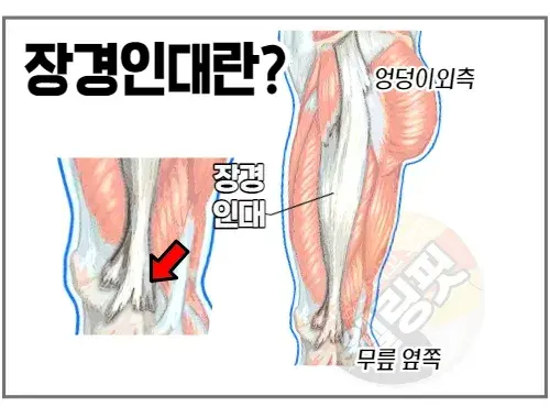 장경인대란