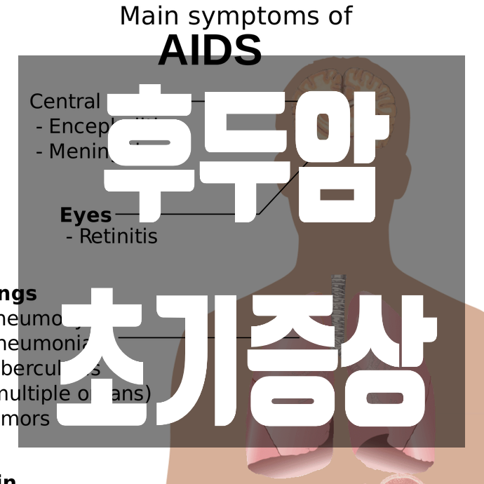  후두암 초기증상과 발병원인, 예방법