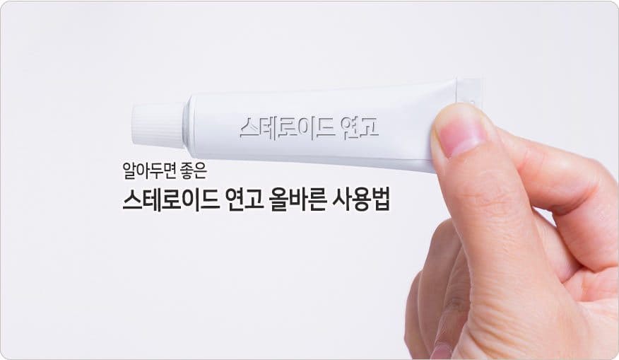  스테로이드 연고 남용하면 안돼요!