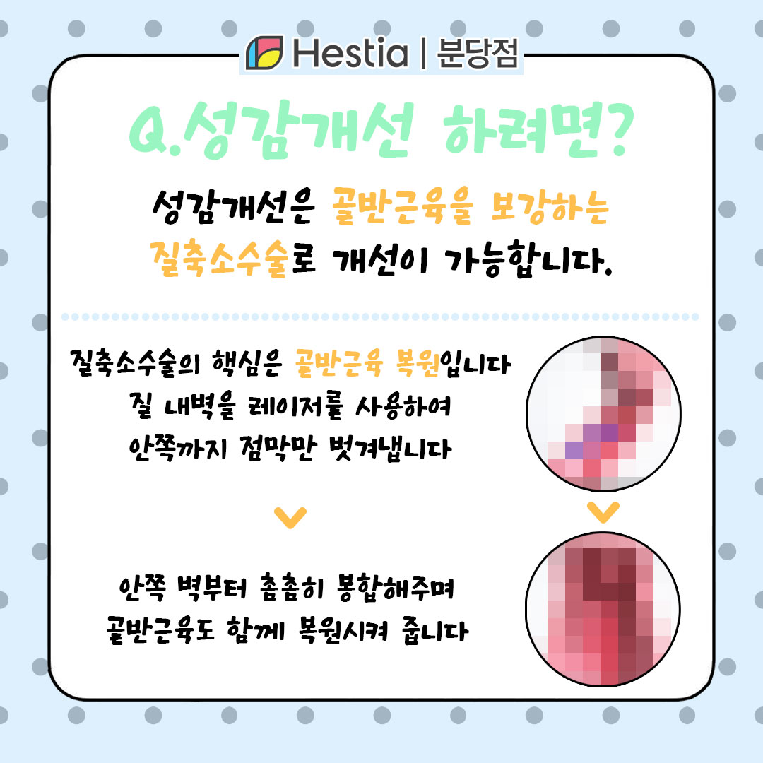 성남여성산부인과 질처짐 성감개선 성감 개선 어떻게 하나요?