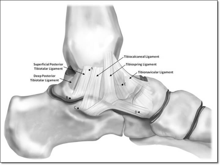 발목 내측 인대를 모두 나타낸 그림으로 부착부를 잘 보여주고 있다.