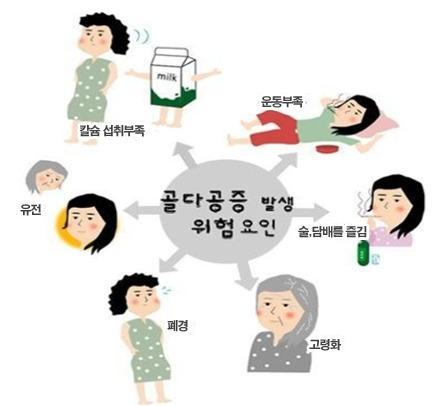 골다공증-원인