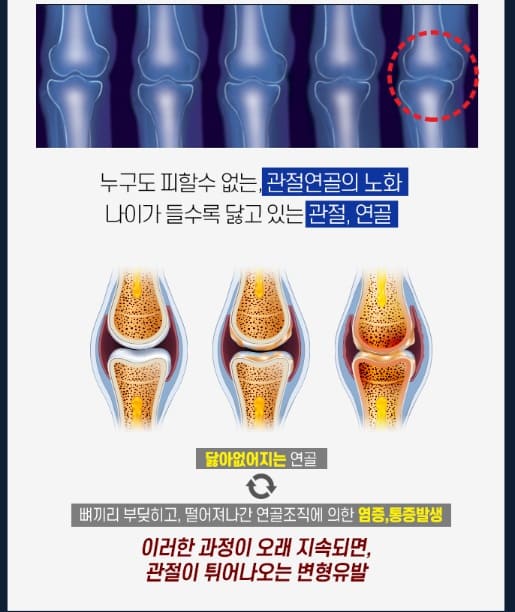 콘드로이친1200 설명