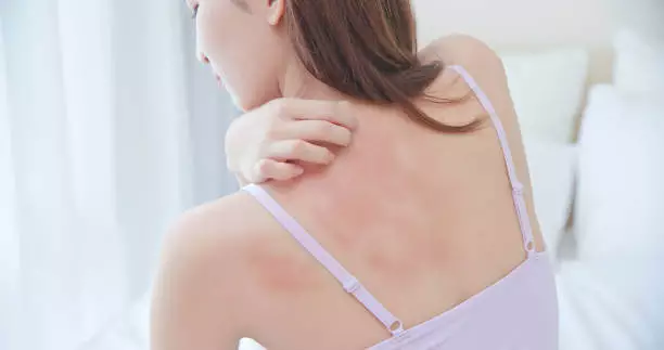 저녁에 피부가려움증의 원인