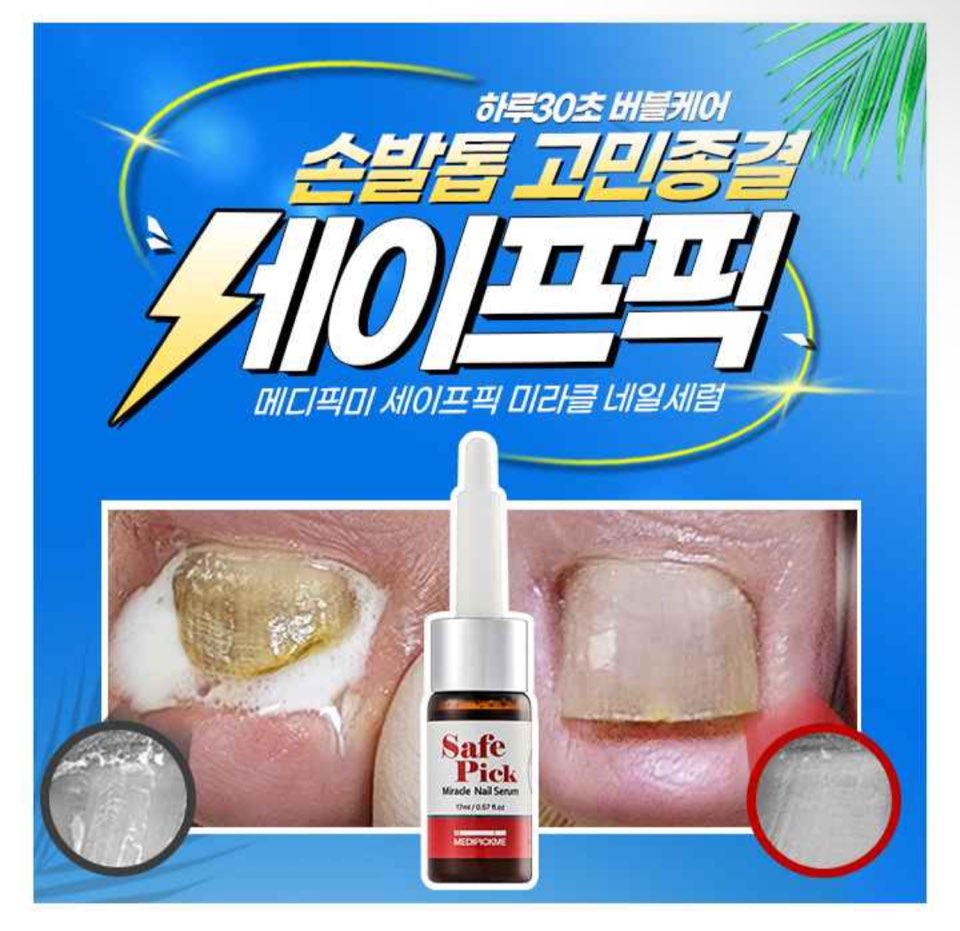 캐시워크 돈버는퀴즈 정답 7월 23일 - undefined - 캐시워크 돈버는퀴즈 정답 7월 23일 - 문제성 손발톱 고민끝! 유해균 버블케어 네일세럼 캐시워크 돈버는퀴즈 정답 7월 23일 - undefined - 캐시워크 돈버는퀴즈 정답 7월 23일 - 문제성 손발톱 고민끝! 유해균 버블케어 네일세럼