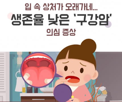 구강암 자가 진단