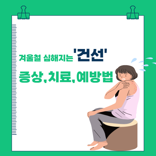  '건선'의 증상 , 치료, 예밥법