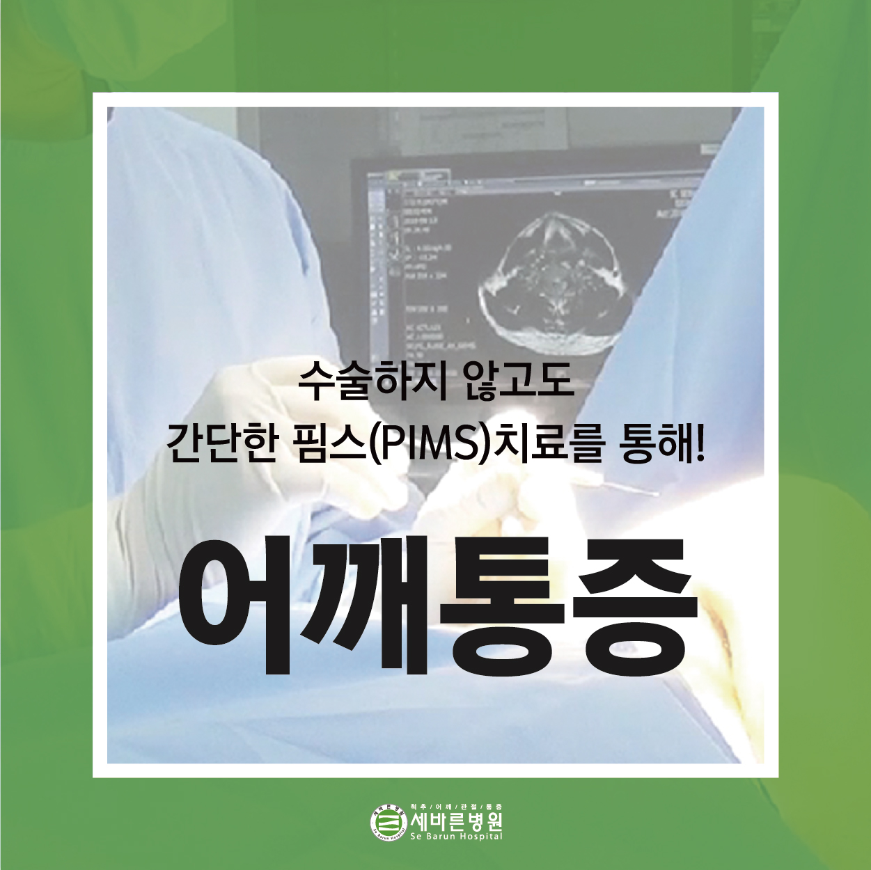  어깨오십견 치료 이제는 비수술로!