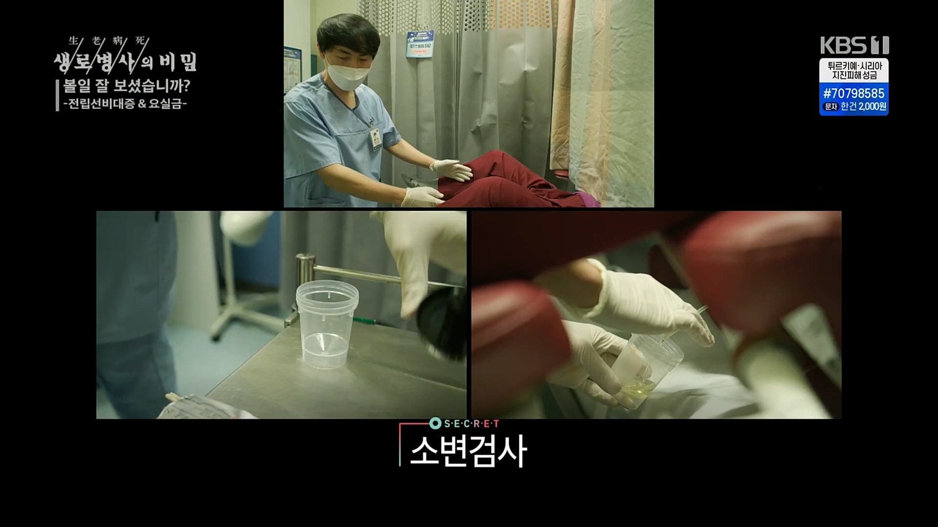 생로병사의 비밀.E856.230215p.H264-F1RST.mp4_20230216_195523.077.jpg