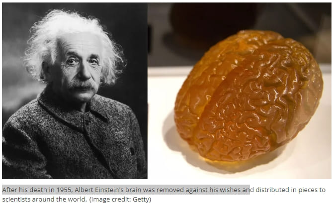 아인슈타인의 뇌는 지금 어디에 있을까? VIDEO: Where is Einstein&#39;s brain?