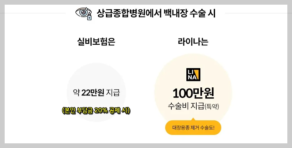 상급종합병원 백내장 수술 시 실비보험, 해당 보험 보장 금액 비교 이미지