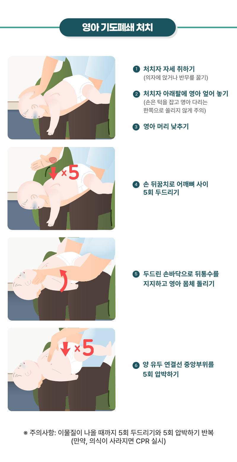 영아 기도폐쇄
