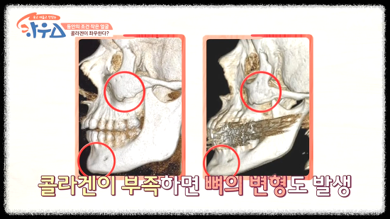 콜라겐