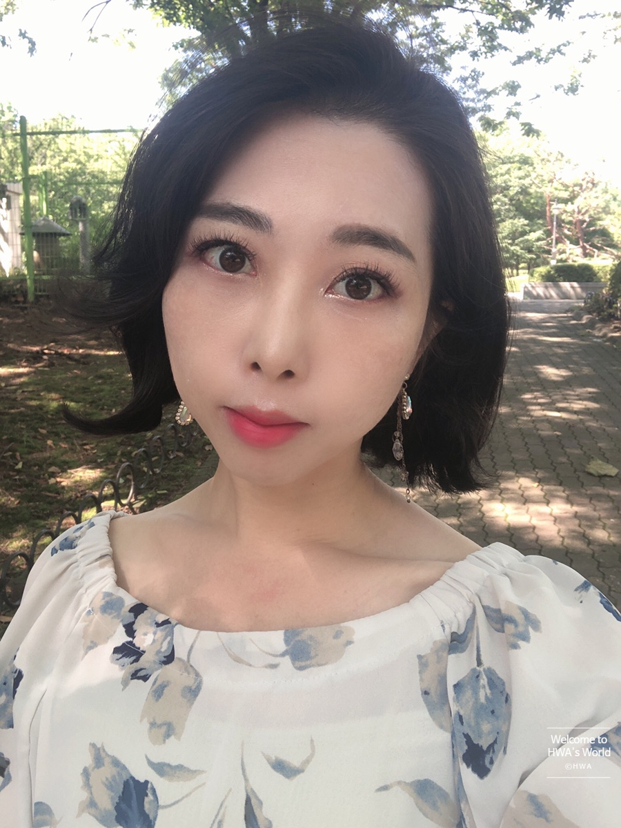 콧볼 축소 비용 [강남/보톡스] 콧볼축소주사-후기 18