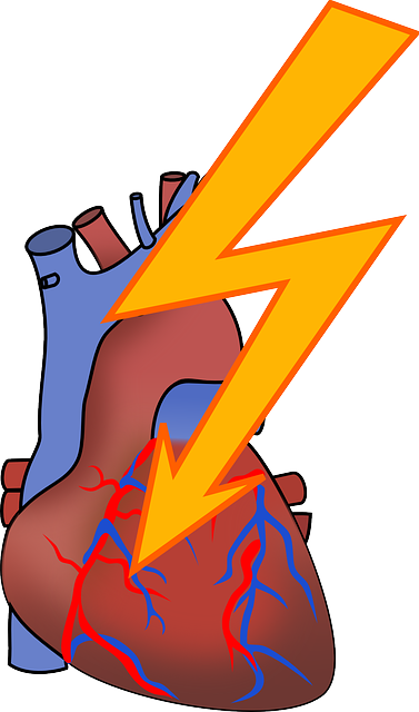 심장그림과 번개모양화살표, 부정맥을 의미하는 사진