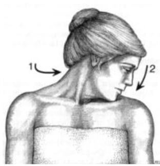 사각근 경련검사를 나타낸 그림으로 고개를 증상이 있는 쪽으로 회전한 후 굴곡하는 그림.