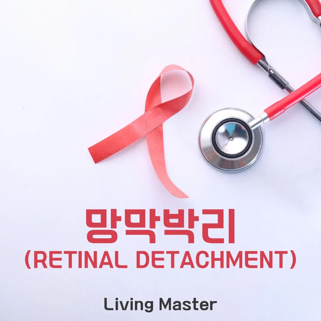 망막박리(Retinal Detachment)