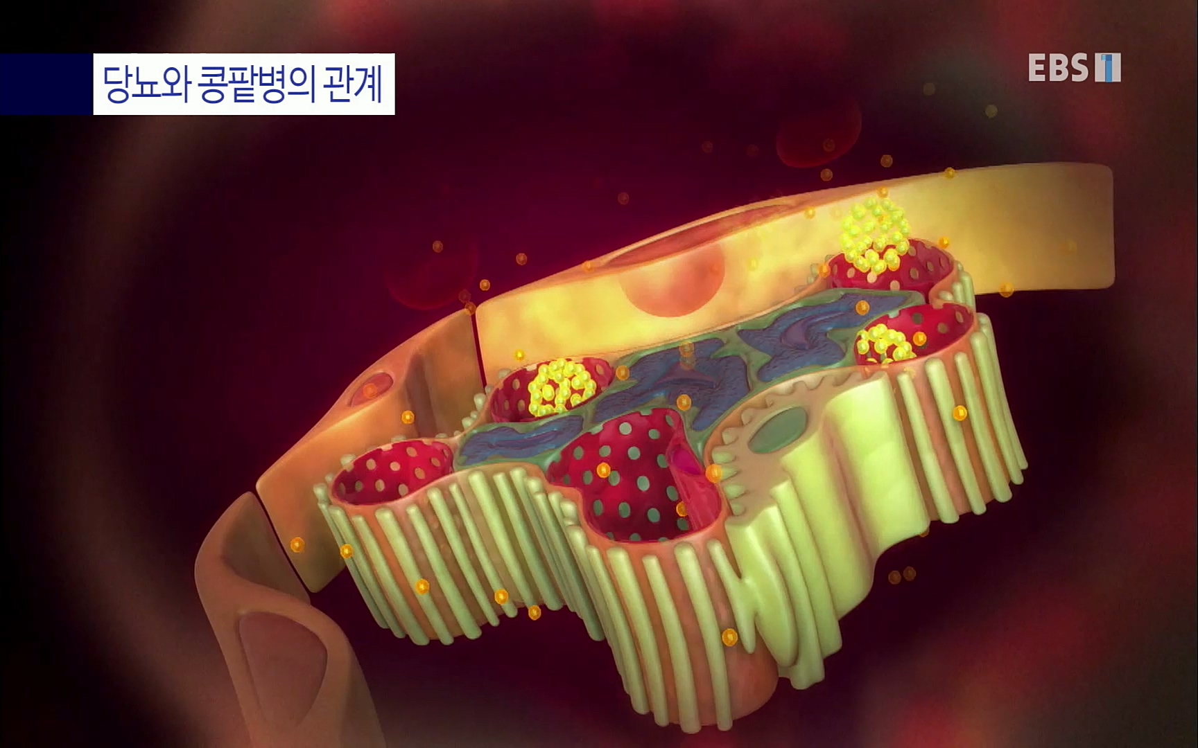 EBS 명의 헬스케어 - TV - 교육의 중심 EBS명의 15년 - 만성 콩팥병 치료, 어디까지 왔나- .mp4_20220802_205722.993.jpg