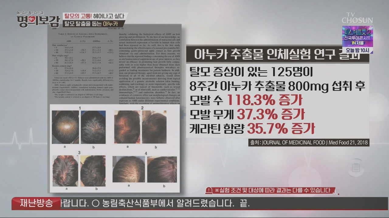 메디컬다큐 명의보감.E03.230527p.H264-F1RST.mp4_20230529_173128.132.jpg