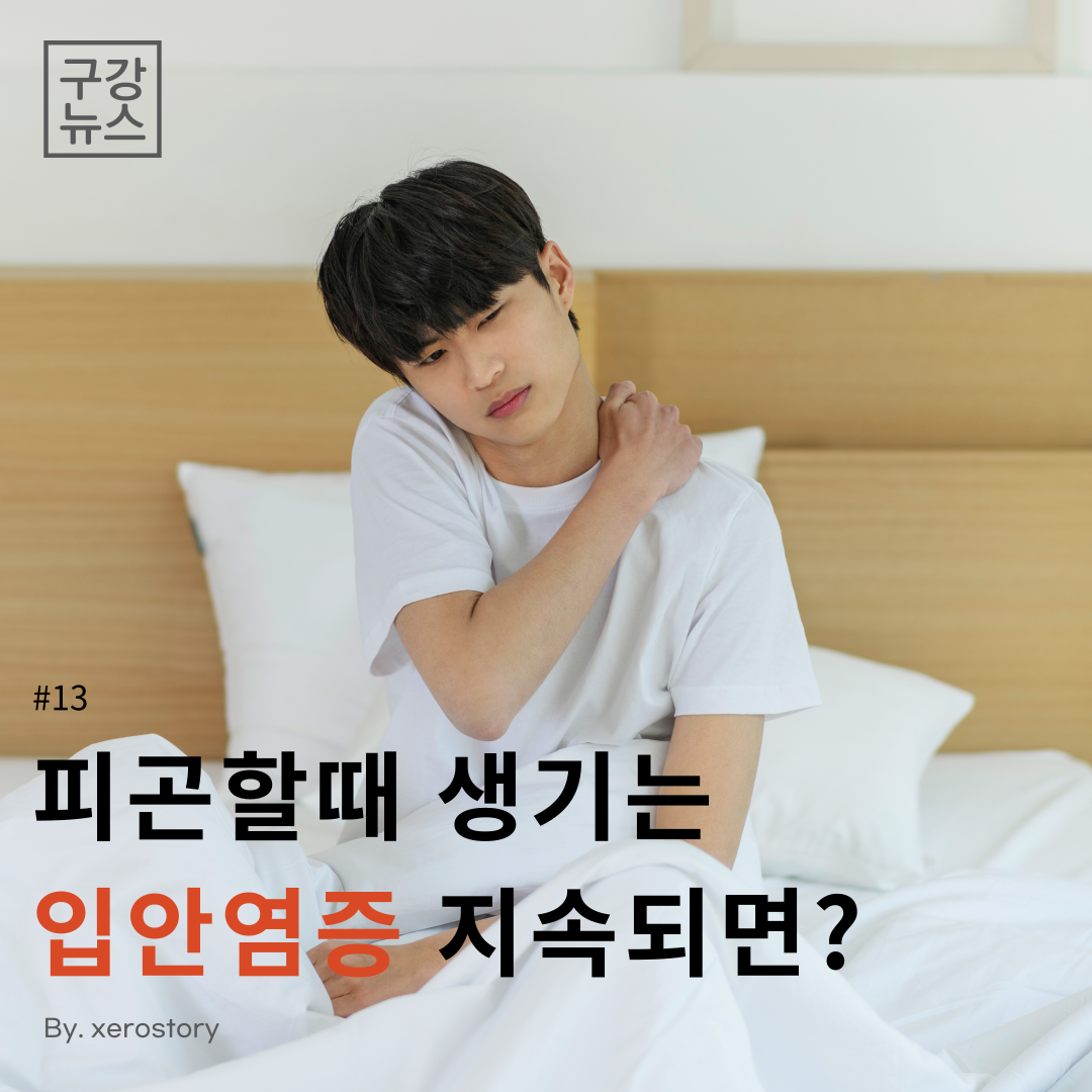  [구강정보] #13 피곤할때 생기는 입안염증 2주이상 지속되면? '이 병' 의심