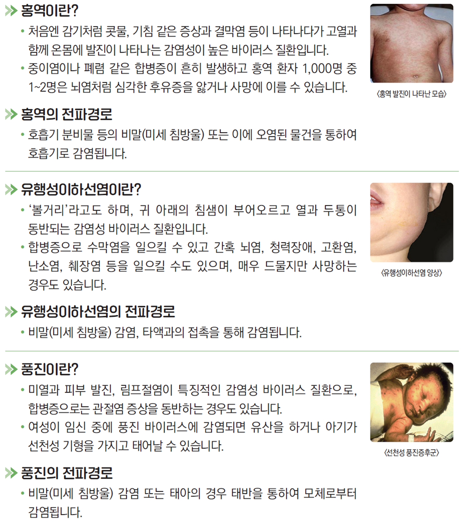 홍역 / 유행성이하선염 / 풍진 감염병 정보