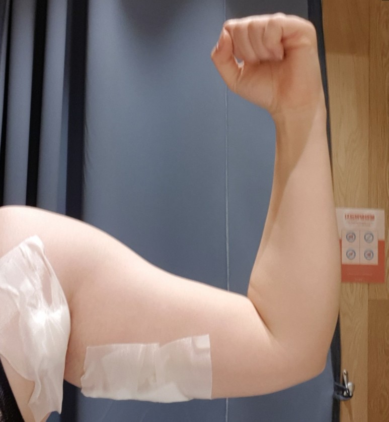 좋네요. 2회차 후기 지방분해주사 팔뚝살빼기 딱 8