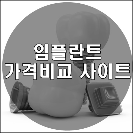  임플란트 가격비교 사이트 정보 총정리