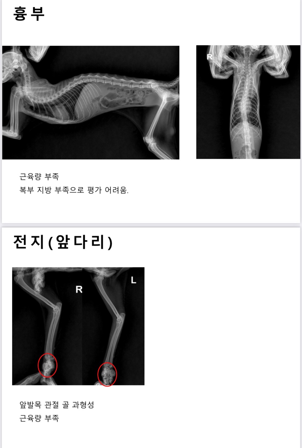  골연골 이형성증 관리법