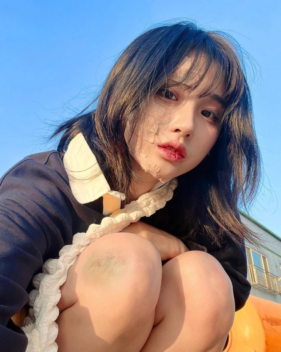  '50만 유튜버' 노은솔, 교통사고 당한 후 뇌진탕에 얼굴 상처까지...심각한 사고 당했다