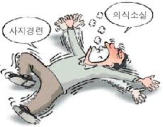  간질 증상 제대로 알아보기