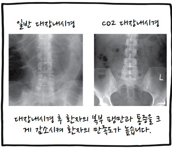 내시경44