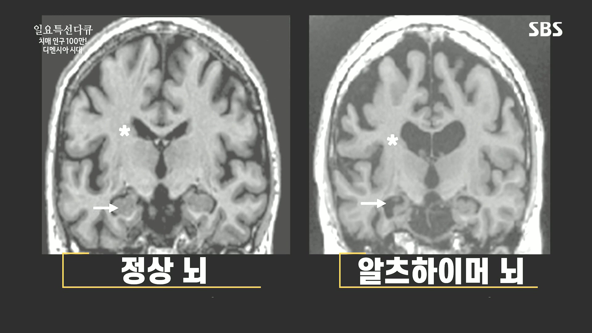 일요 특선 다큐멘터리.E349.240811p.H264-F1RST.mp4_20240811_173210.042.jpg