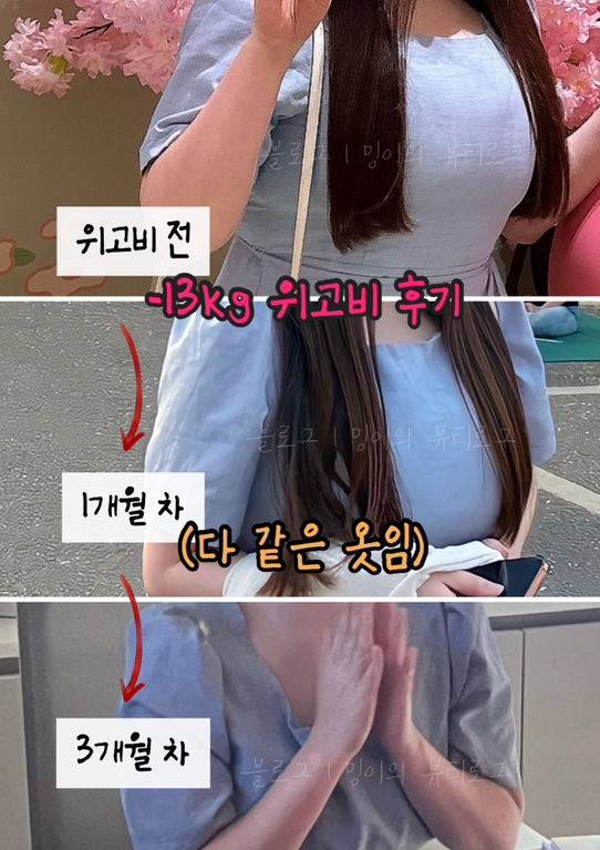 위고비후기사진