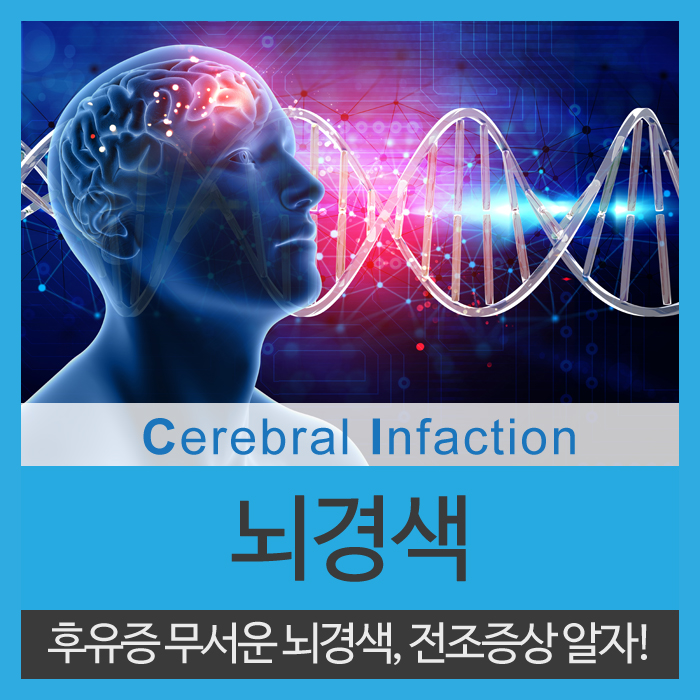  뇌경색 전조 증상 꼭 확인하자