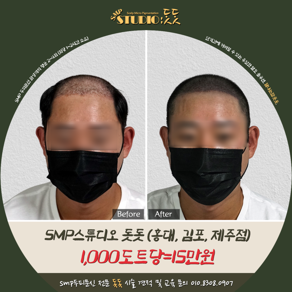  인천두피문신 반삭발 스타일에 모자람 없이 채움